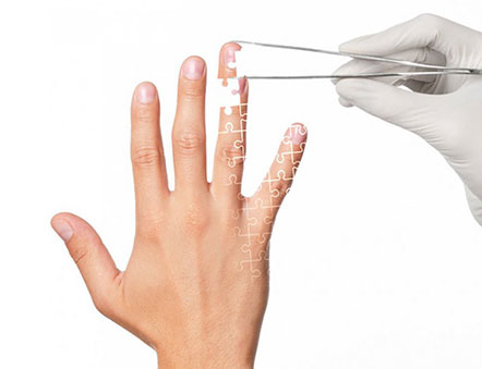 dr burak ergun tatar onarim cerrahisi