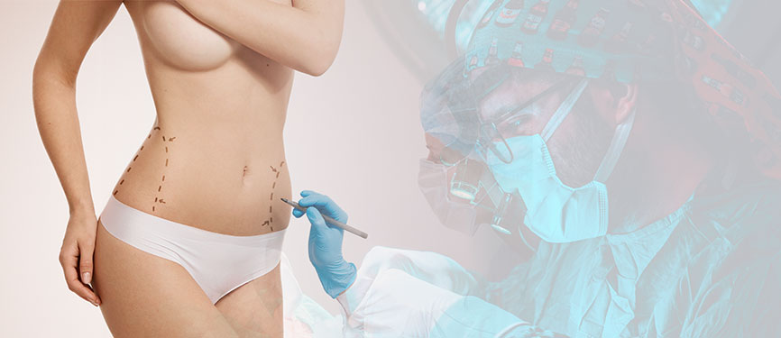 Liposuction 1 Liposuction tedavi