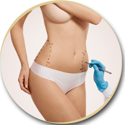 Liposuction