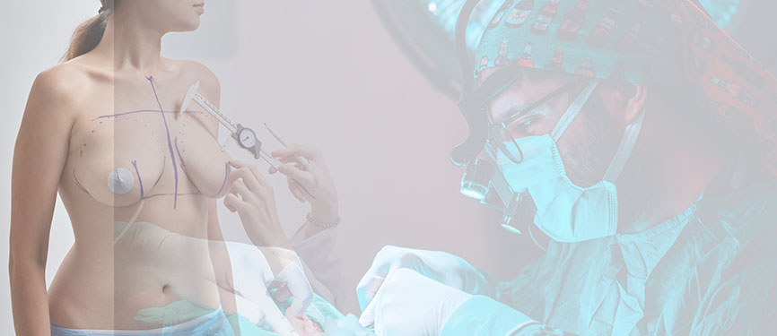 Meme Büyütme 1 Breast augmentation i