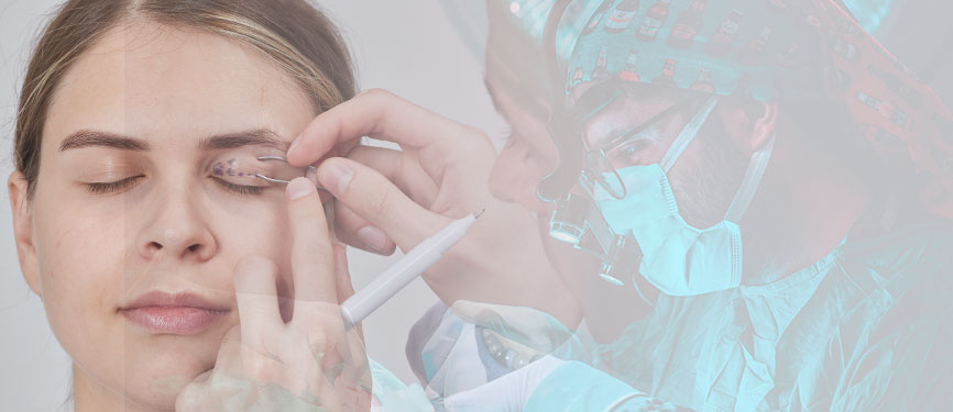 Upper blepharoplasty